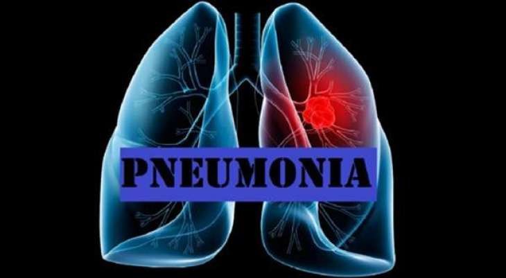 Pneumonia-1